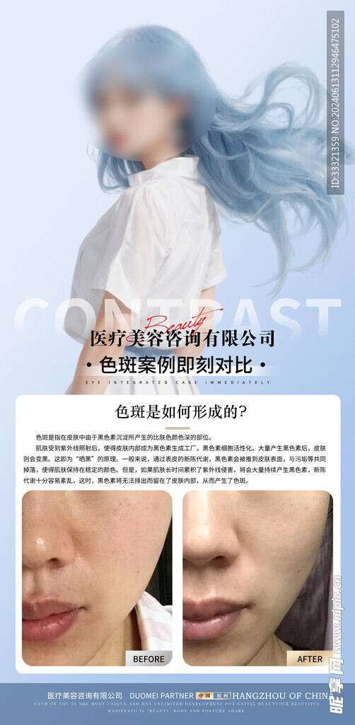色斑对比