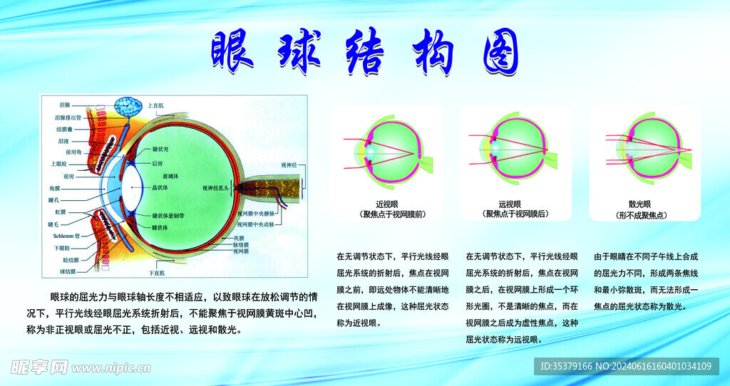 眼球结构图