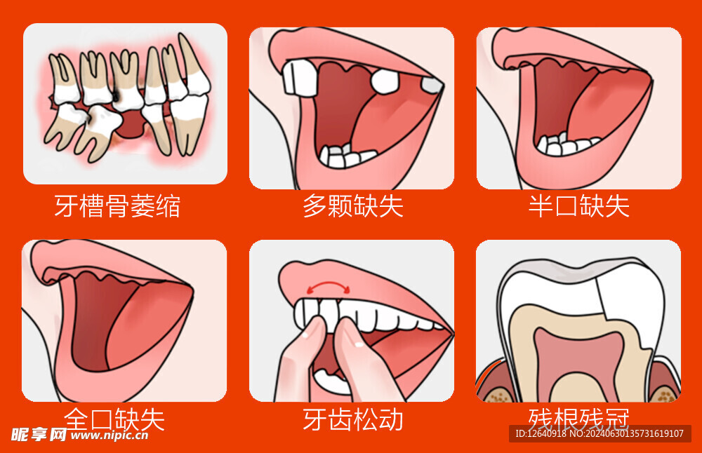 缺牙牙齿缺失