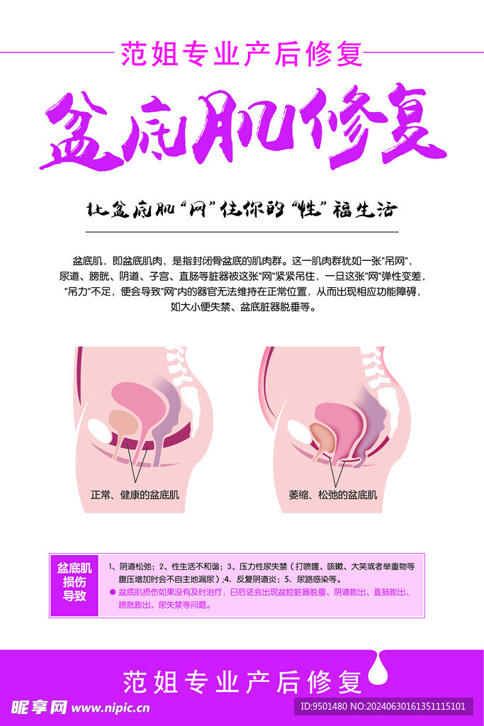 盆底修复 