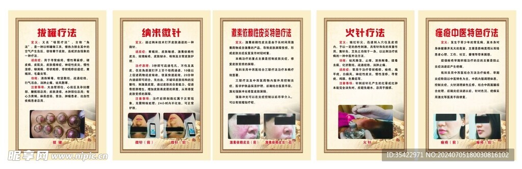 中医疗法制度牌 拔罐