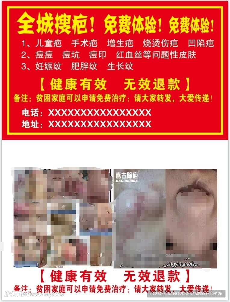 疤痕治疗名片