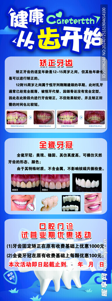 牙齿矫正易拉宝展架