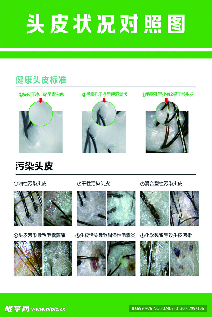 头皮状况对照图