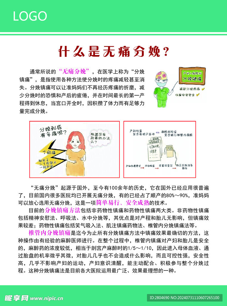 无痛分娩