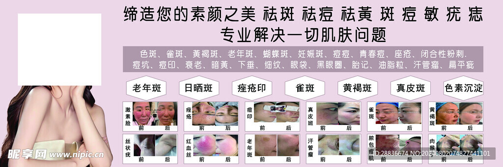 美容 美白
