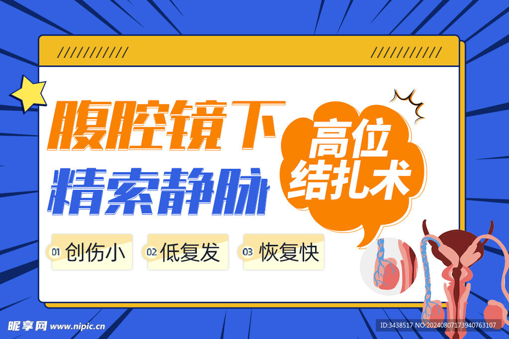 精索静脉高位结扎术标准页封面 