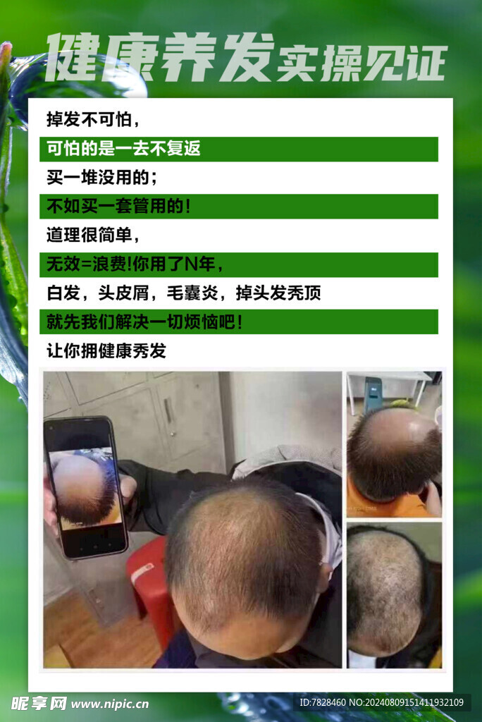 健康养发实操见证