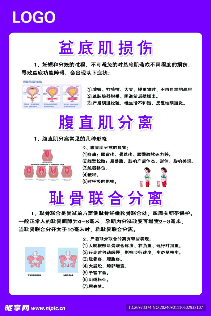 盆底肌损伤