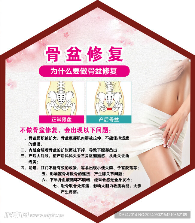 骨盆修复 