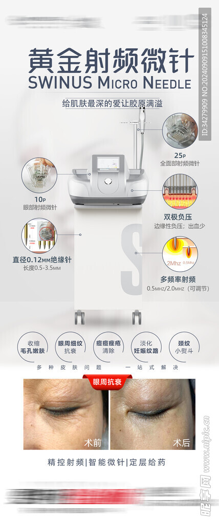 黄金射频微针