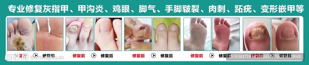 脚病