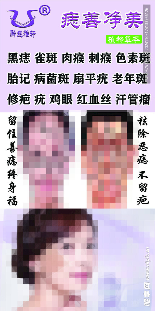 美容院祛斑灯箱