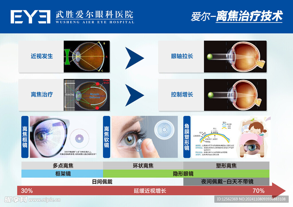 离焦治疗