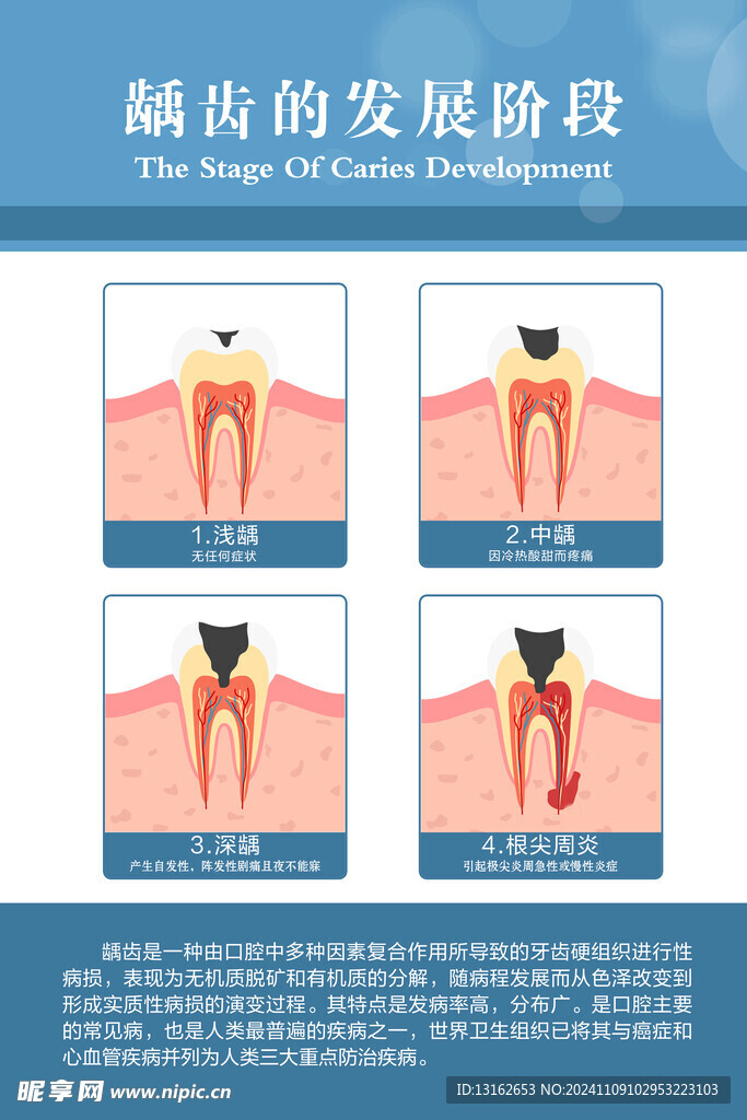 龋齿的  发展阶段