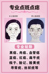 点痣