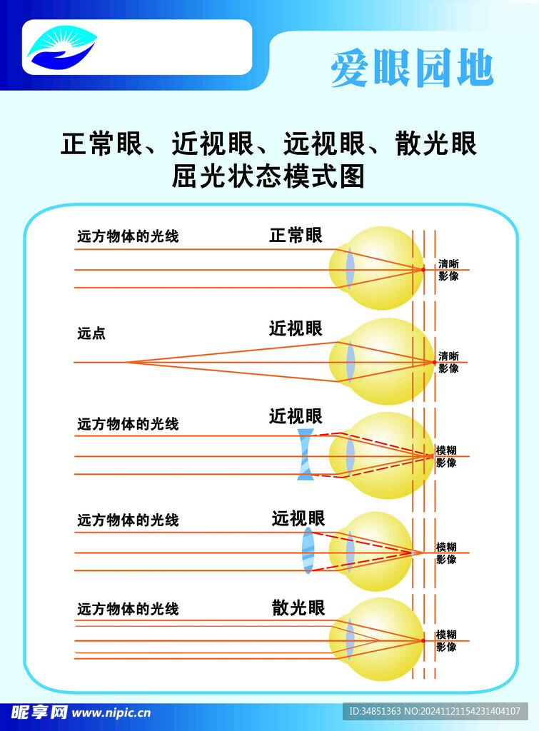 视力模式图