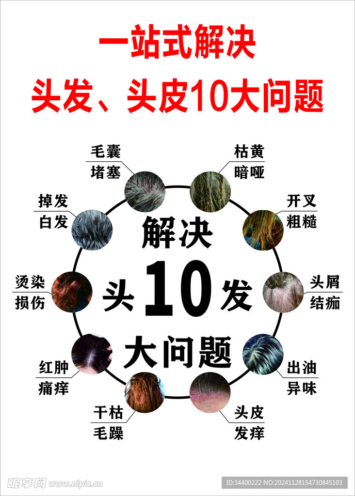 解决头发10大问题