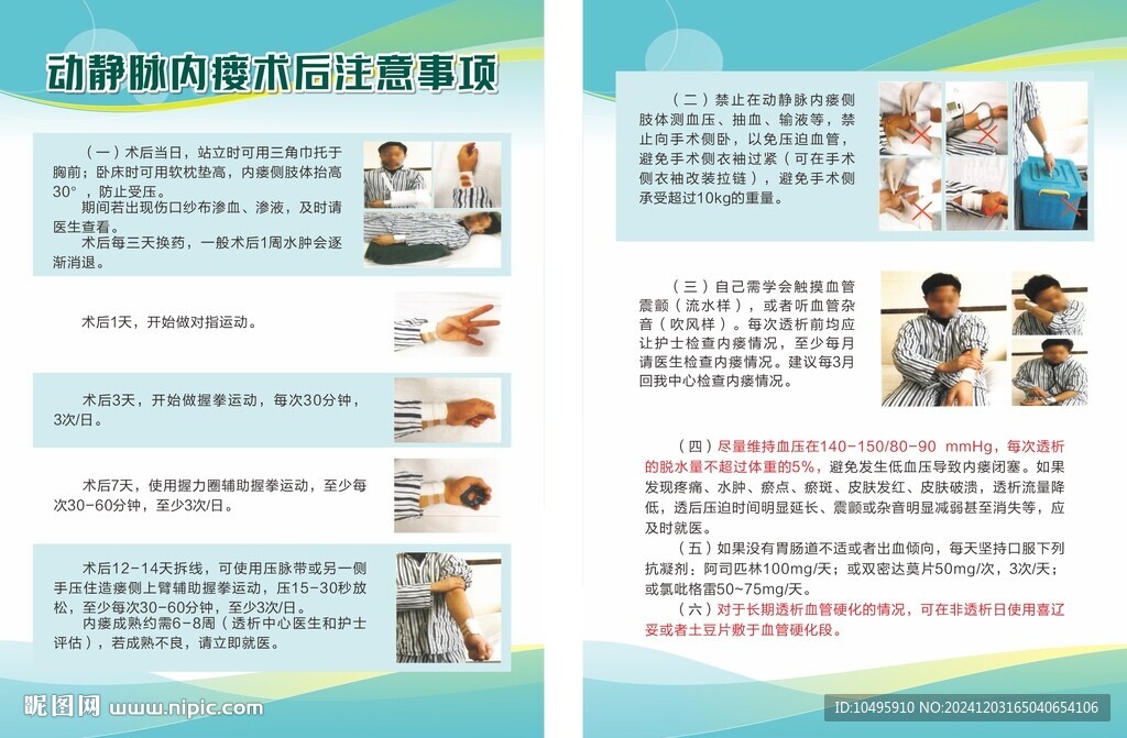 动静脉内瘘术后注意事项