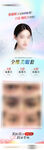 全维美眼套餐眼部抗衰海报