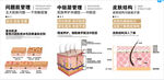 皮肤分层问题展板