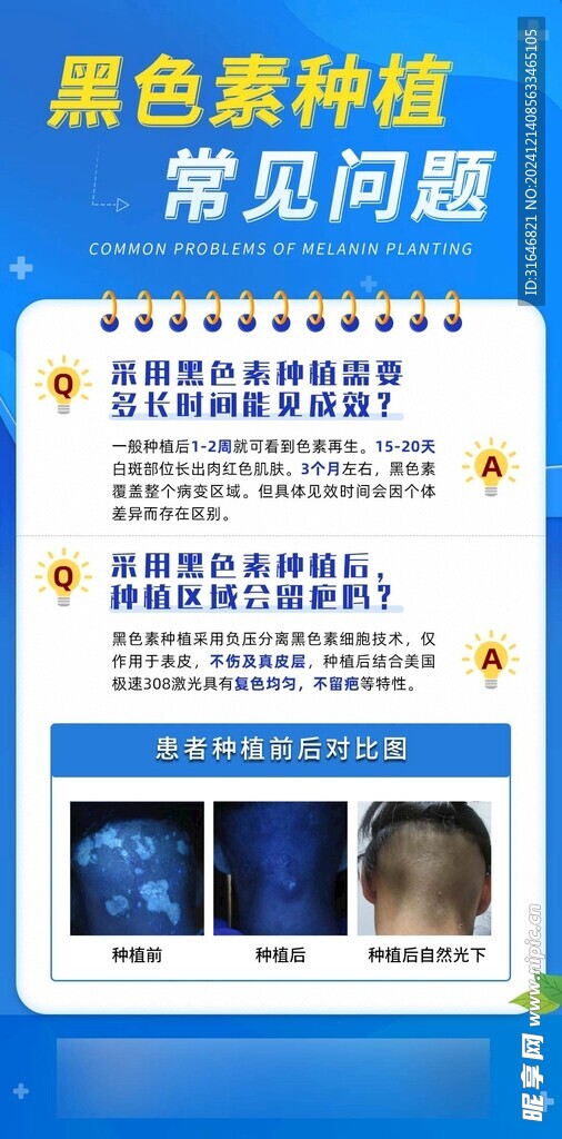 蓝色科普医疗黑色素介绍医用海报