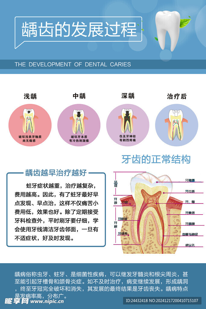 龋齿的发展过程