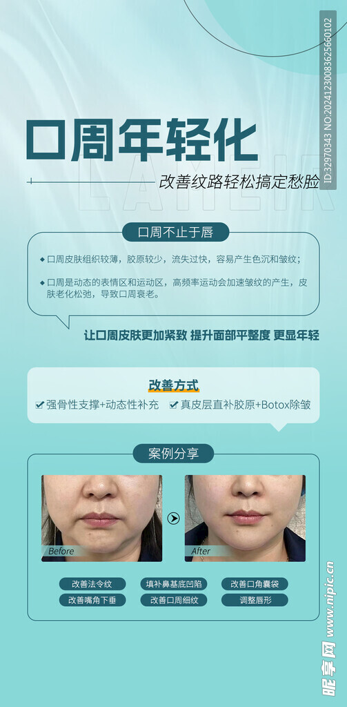 医美活动海报