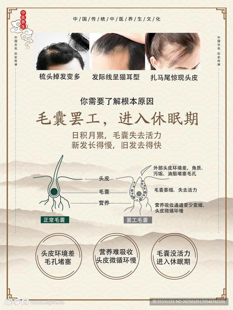 中医养发