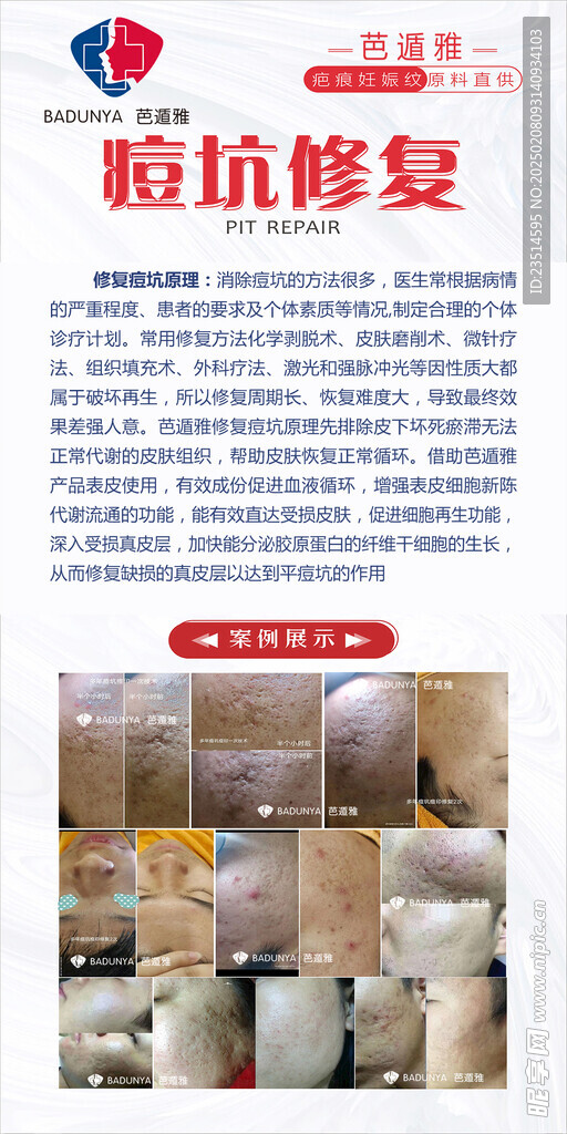 痘坑修复