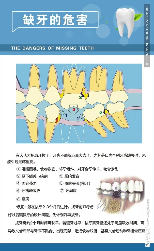 牙科 海报 宣传  诊所 治疗