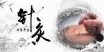 中医针灸