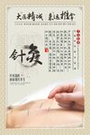 中医针灸