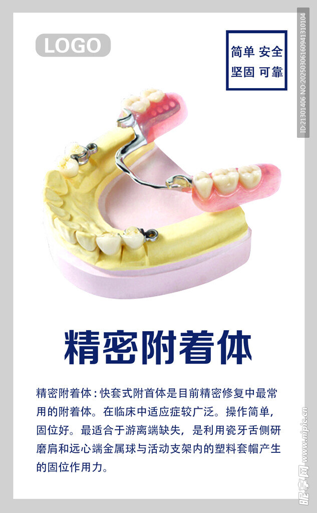 精密附着体海报 精密件