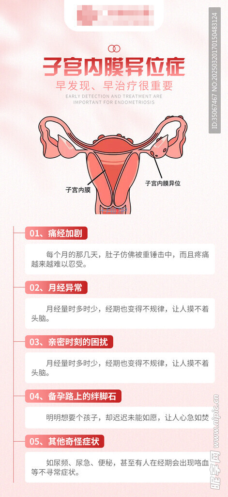 妇科子宫内膜异位症