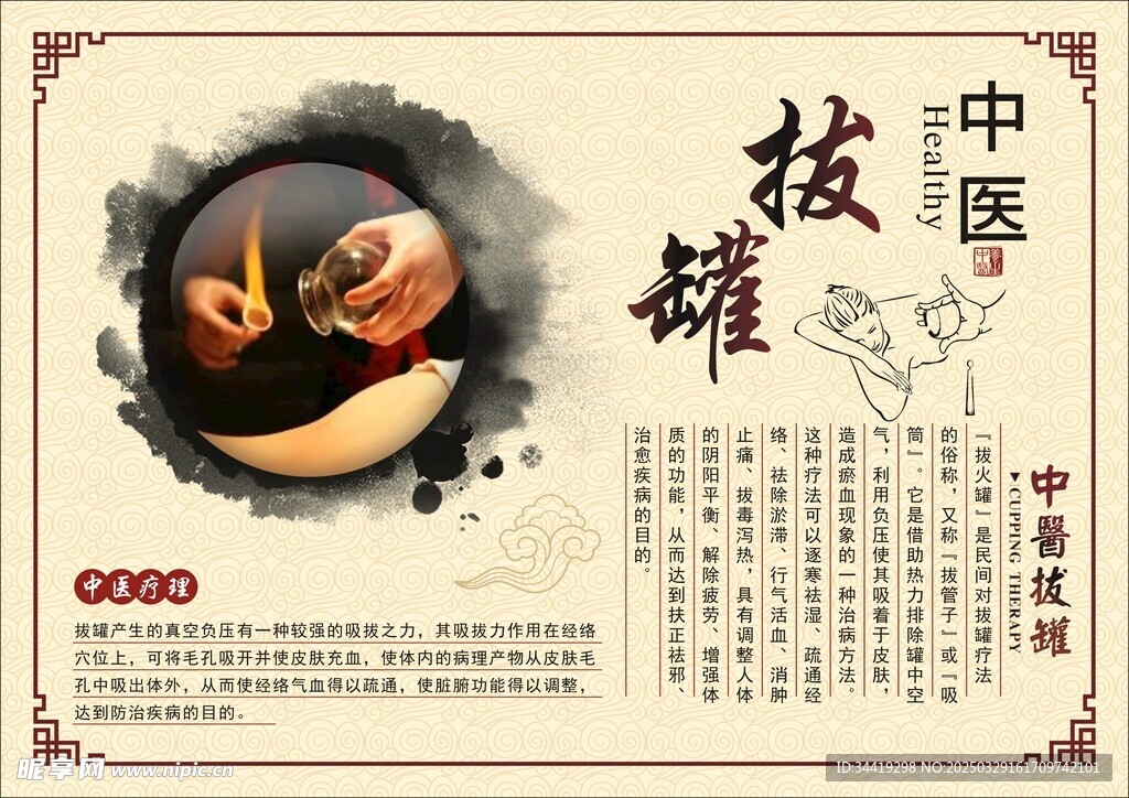 拔罐