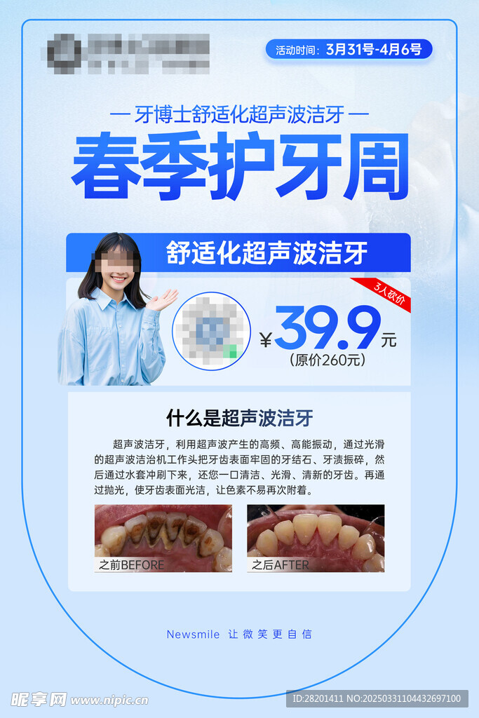 春季护牙周超声波洁牙