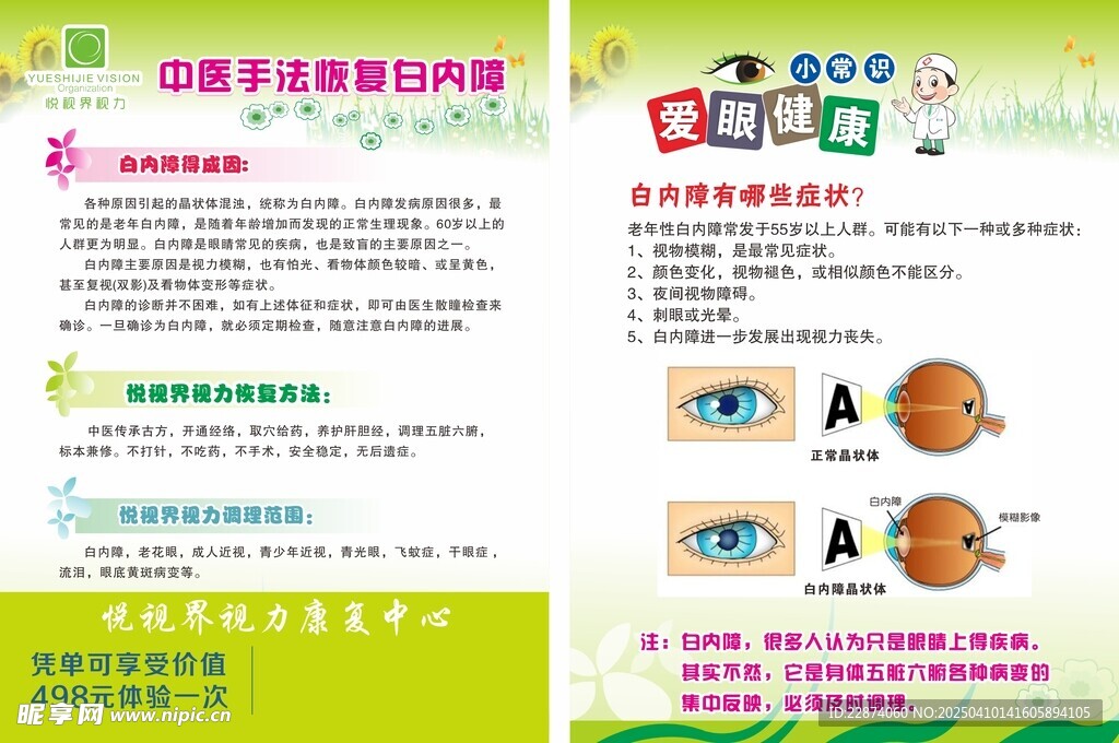 白内障