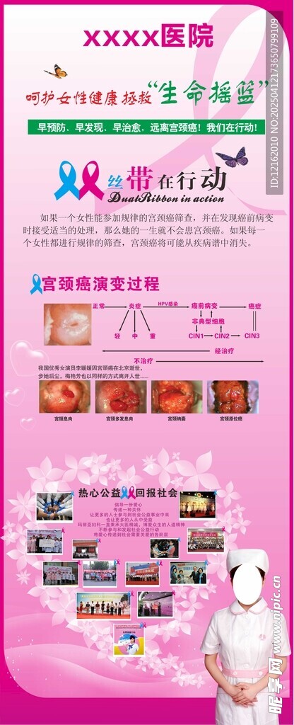 妇科宫颈癌