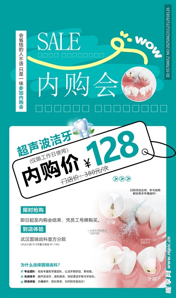 超声波洁牙