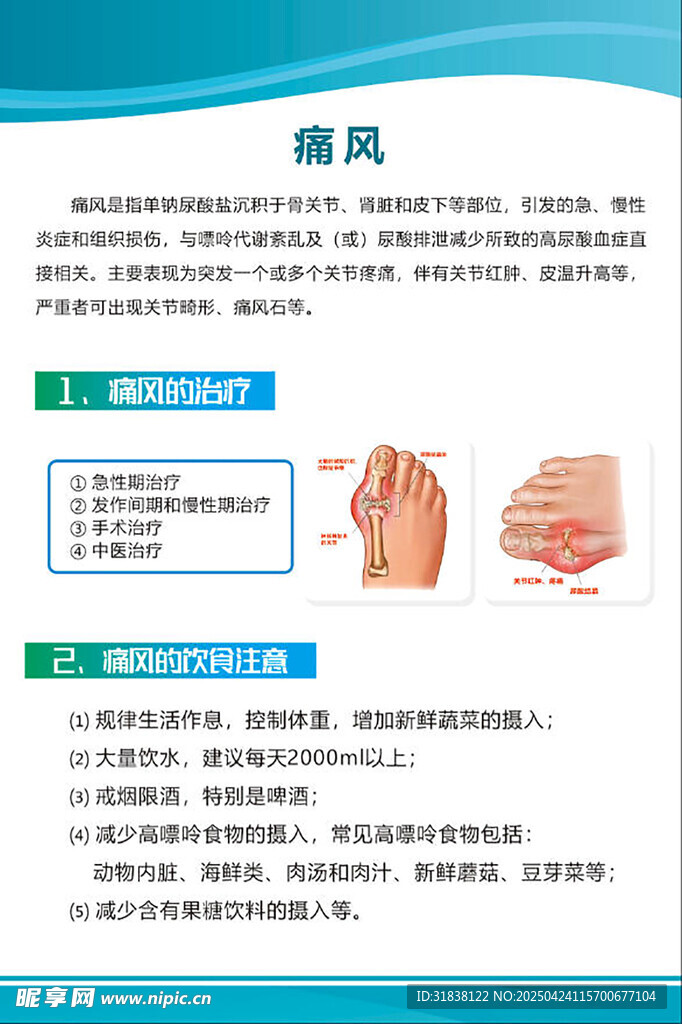 痛风知识科普页面展示