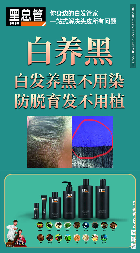 脱发