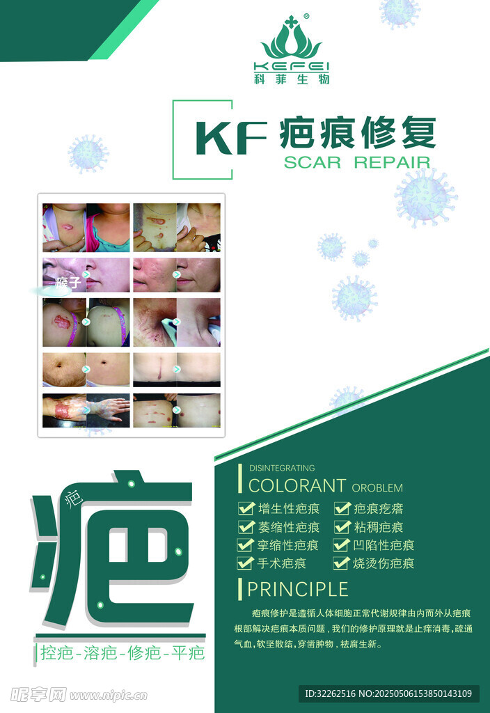斑疤敏痘疣