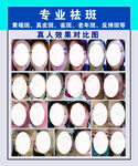 专业祛斑