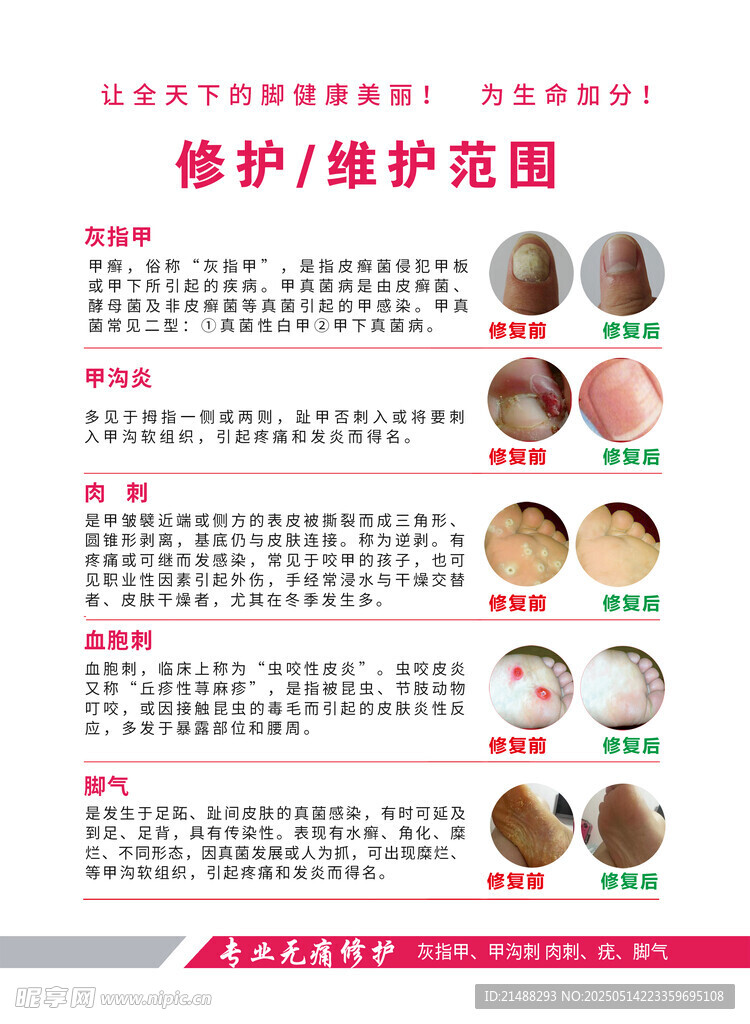 脚修护维护范围介绍