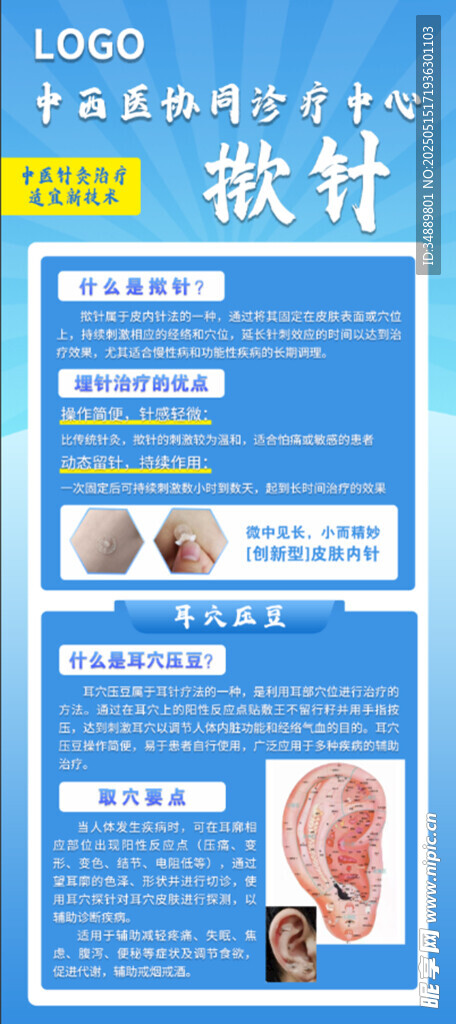 掀针耳穴压豆展架易拉宝海报
