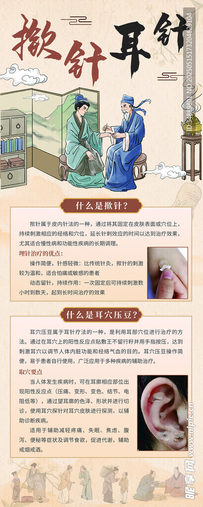 掀针耳针耳穴压豆中式易拉宝展架