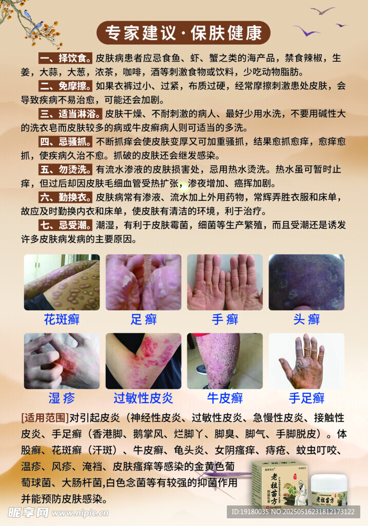 中医祛除牛皮癣