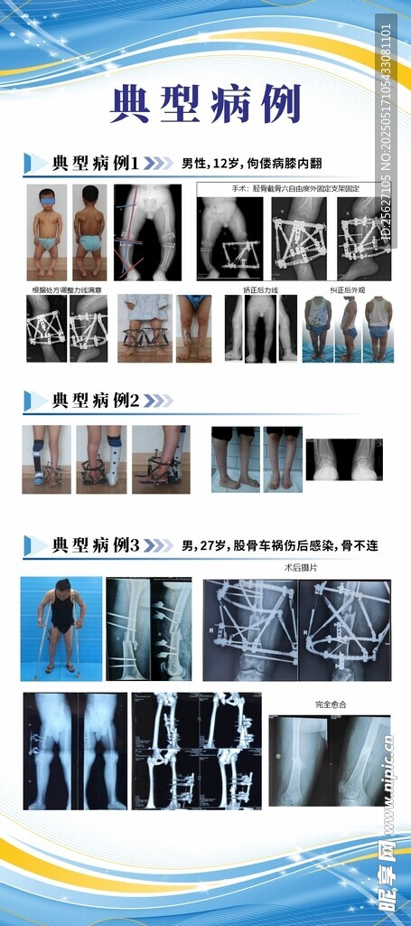 展架易拉宝