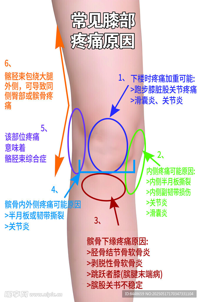 膝关节结构解剖示意图